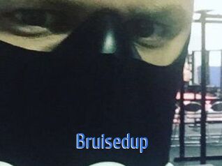 Bruisedup